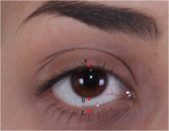 Иллюстрация к статье: Scleral Show